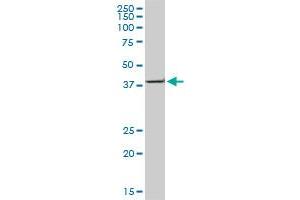 ACAA2 monoclonal antibody (M05), clone 2F7. (ACAA2 antibody  (AA 151-260))