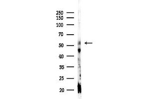 Western blot analysis of lysates from Hela cells(starvation,24h treatment), using Cytokeratin 10 Antibody at 1/1000 dilution.