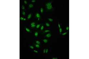 Immunofluorescence staining of HepG2 cells(treated with 50 mM Calyculin A for 30 min) with ABIN7127739 at 1:100,counter-stained with DAPI. (Recombinant RAF1 antibody  (pSer621))
