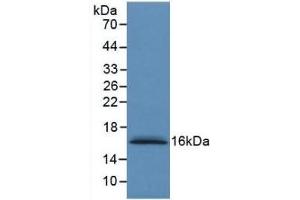 Detection of Recombinant S100A6, Human using Monoclonal Antibody to S100 Calcium Binding Protein A6 (S100A6) (S100A6 antibody  (AA 1-90))