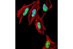 Fluorescent confocal image of  cell stained with TBX1 Antibody (C-term) (ABIN653331 and ABIN2842819). (T-Box 1 antibody  (C-Term))