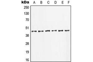 Western blot analysis of c-Jun expression in HeLa (A), U2OS (B), HCT116 (C), NIH3T3 (D), PC12 (E), rat kidney (F) whole cell lysates.