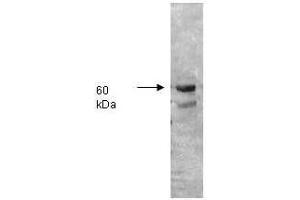 Both the antiserum and IgG fractions of anti-Alkaline Phosphatase (Human Intestine) are shown to detect under reducing conditions of SDS-PAGE the 60,000 dalton enzyme in cellular extracts. (Alkaline Phosphatase antibody)