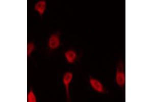 Immunofluorescence (fixed cells) (IF/ICC) image for anti-Cell Division Cycle 25 Homolog A (S. Pombe) (CDC25A) (pSer124) antibody (ABIN6256120)