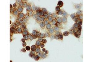 ICC testing of HNF6 antibody and HCT116 cells (ONECUT1 antibody  (N-Term))
