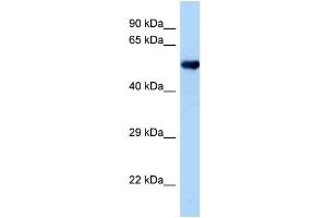 WB Suggested Anti-Oxsr1 Antibody   Titration: 1. (OXSR1 antibody  (Middle Region))