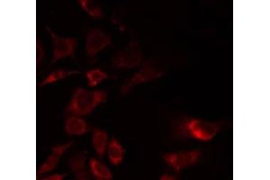 ABIN6268852 staining HeLa by IF/ICC. (GORASP2 antibody  (Internal Region))