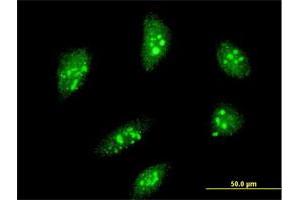 Immunofluorescence of monoclonal antibody to MEOX2 on HeLa cell. (MEOX2 antibody  (AA 1-303))