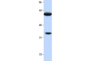 Host:  Rabbit  Target Name:  HRG  Sample Type:  Human Liver  Antibody Dilution:  1. (HRG antibody  (Middle Region))