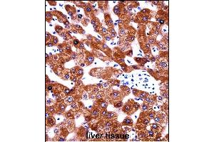CYB5A Antibody (Center) ((ABIN657954 and ABIN2846899))immunohistochemistry analysis in formalin fixed and paraffin embedded human liver tissue followed by peroxidase conjugation of the secondary antibody and DAB staining. (CYB5A antibody  (AA 69-98))