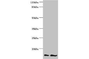 Western blot All lanes: NEDD8 antibody at 16 μg/mL Lane 1: Mouse heart tissue Lane 2: Mouse spleen tissue Secondary Goat polyclonal to rabbit IgG at 1/10000 dilution Predicted band size: 9 kDa Observed band size: 9 kDa (NEDD8 antibody  (AA 1-81))