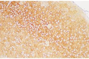 Immunohistochemistry of paraffin-embedded Mouse brain using TGFBR1 Polycloanl Antibody at dilution of 1:200 (TGFBR1 antibody)