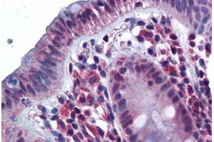 Human Colon (formalin-fixed, paraffin-embedded) stained with CD180 antibody ABIN343899 at 5 ug/ml followed by biotinylated goat anti-rabbit IgG secondary antibody ABIN481713, alkaline phosphatase-streptavidin and chromogen. (CD180 antibody  (N-Term))