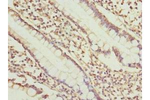 Immunohistochemistry of paraffin-embedded human small intestine tissue using ABIN7149657 at dilution of 1:100 (SGCD antibody  (AA 60-289))