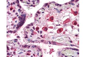 Immunohistochemistry (IHC) image for anti-Eomesodermin (EOMES) (C-Term) antibody (ABIN2779928) (EOMES antibody  (C-Term))