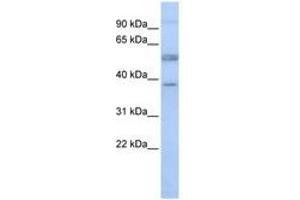 Image no. 1 for anti-Lymphocyte-Specific Protein 1 (LSP1) (AA 36-85) antibody (ABIN6741485) (LSP1 antibody  (AA 36-85))