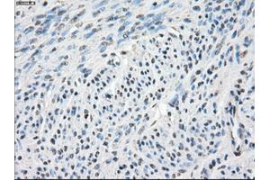 Immunohistochemistry (IHC) image for anti-Carbonic Anhydrase IX (CA9) antibody (ABIN1497095) (CA9 antibody)