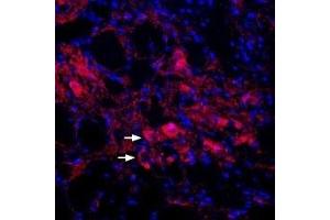 Expression of KCNQ4 (KV7.
