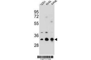 TPM4 Antibody (N-term) western blot analysis in U251,A549,Jurkat cell line lysates (35 µg/lane).