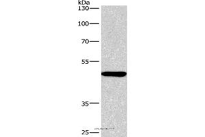 Western blot analysis of A549 cell, using BMP15 Polyclonal Antibody at dilution of 1:266.