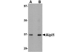 Western blot analysis of Aipl1 in human brain tissue lysate with AP30036PU-N Aipl1 antibody at (A) 1 and (B) 2 μg/ml.