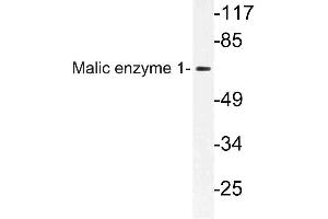 Western blot (WB) analysis of Malic enzyme 1 antibody in extracts from HeLa cells. (ME1 antibody)