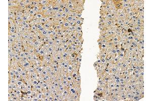 ABIN6259423 and ABIN6276212 at 1/100 staining mouse liver tissue by IHC-P.