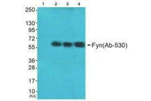 Western blot analysis of extracts from HeLa cells (Lane 2), A549 cells (Lane 3) and HepG2 cells (Lane 4), using Fyn (Ab-530) antiobdy. (FYN antibody  (Tyr530))