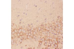 Anti-FSH beta Picoband antibody,  IHC(P): Mouse Brain Tissue (FSHB antibody  (AA 19-129))