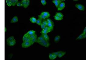 Immunofluorescence staining of HepG2 cells with ABIN7160580 at 1:100, counter-stained with DAPI. (MYH4 antibody  (AA 896-1045))
