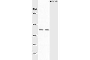 L1 Mouse intestine lysate L2 mouse liver lysates probed with Rabbit Anti-LAMP2/CD107B Polyclonal Antibody, Unconjugated  at 1:3000 for 90 min at 37˚C. (LAMP2 antibody  (AA 301-411))