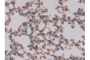 Detection of TFAM in Mouse Lung Tissue using Polyclonal Antibody to Transcription Factor A, Mitochondrial (TFAM) (TFAM antibody  (AA 43-243))