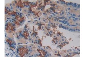 DAB staining on IHC-P; Samples: Mouse Stomach Tissue (PAG1 antibody  (AA 160-390))