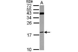 WB Image Sample (30 ug of whole cell lysate) A: U87-MG 15% SDS PAGE antibody diluted at 1:500 (ATP6V1F antibody)