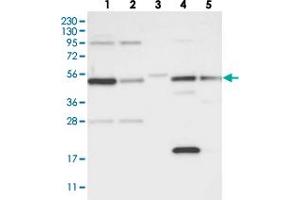 Western blot analysis of Lane 1: RT-4, Lane 2: U-251 MG, Lane 3: Human Plasma, Lane 4: Liver, Lane 5: Tonsil with ATG4A polyclonal antibody  at 1:250-1:500 dilution. (ATG4A antibody)