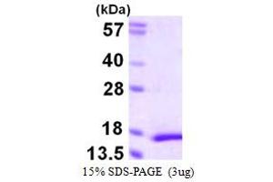 SDS-PAGE (SDS) image for Myosin, Light Chain 5, Regulatory (MYL5) (AA 1-132) protein (His tag) (ABIN667952) (MYL5 Protein (AA 1-132) (His tag))