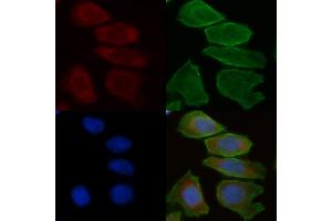 ABIN6258708 and ABIN6275305 staining Hela cells(30 min of UV treatment) by IF/ICC. (CHRNA10 antibody  (C-Term))