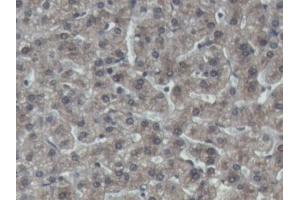 DAB staining on IHC-P; Samples: Porcine Liver Tissue (IGFBP4 antibody  (AA 23-259))