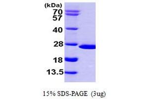 SDS-PAGE (SDS) image for Nudix (Nucleoside Diphosphate Linked Moiety X)-Type Motif 16 (NUDT16) (AA 1-195) protein (His tag) (ABIN667321)