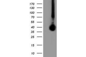 Western Blotting (WB) image for anti-Family with Sequence Similarity 84, Member B (FAM84B) antibody (ABIN1498208) (FAM84B antibody)