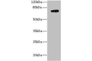 Western blot All lanes: DARS2 antibody at 10 μg/mL + MCF-7 whole cell lysate Secondary Goat polyclonal to rabbit IgG at 1/10000 dilution Predicted band size: 74 kDa Observed band size: 74 kDa (DARS2 antibody  (AA 489-628))