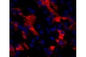 Immunofluorescence analysis of Human stomach tissue using CD284 Polyclonal Antibody at dilution of 1:200. (TLR4 antibody)