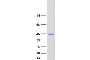 NDRG Family Member 2 (NDRG2) (Transcript Variant 8) protein (Myc-DYKDDDDK Tag)
