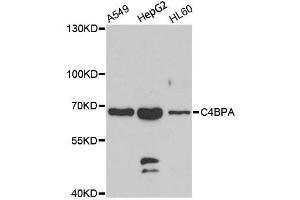 Western blot analysis of extracts of various cell lines, using C4BPA antibody. (C4BPA antibody  (C-Term))
