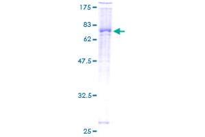 Image no. 2 for zeta-Chain (TCR) Associated Protein Kinase 70kDa (ZAP70) (AA 1-493) protein (GST tag) (ABIN1325570) (ZAP70 Protein (AA 1-493) (GST tag))