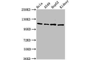Western Blot Positive WB detected in: Hela whole cell lysate, A549 whole cell lysate, HepG2 whole cell lysate, Rat kidney tissue All lanes: NFATC3 antibody at 4. (NFATC3 antibody  (AA 887-1070))