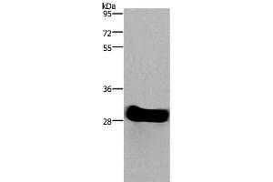 Western Blot analysis of Mouse heart tissue using FHL2 Polyclonal Antibody at dilution of 1:1900 (FHL2 antibody)