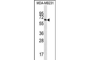 GBP1 Antibody (N-term) (ABIN656423 and ABIN2845715) western blot analysis in MDA-M cell line lysates (35 μg/lane). (GBP1 antibody  (N-Term))