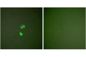 Immunofluorescence analysis of NIH-3T3 cells, using Galectin 3 Antibody. (Galectin 3 antibody  (AA 141-190))