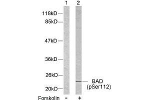 Image no. 2 for anti-BCL2-Associated Agonist of Cell Death (BAD) (pSer112), (pSer75) antibody (ABIN196735) (BAD antibody  (pSer75, pSer112))